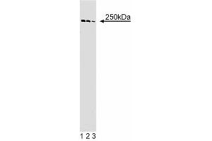 Western blot analysis of alpha-Spectrin II on Jurkat cell lysate. (SPTAN1 Antikörper  (AA 252-371))