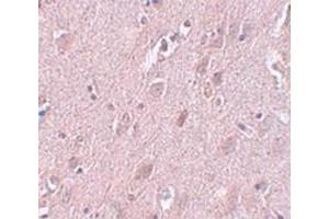 Immunohistochemical staining of human brain tissue with ZC3H12B polyclonal antibody  at 5 ug/mL dilution. (ZC3H12B Antikörper  (N-Term))