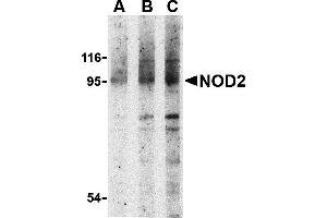 Western Blotting (WB) image for anti-Nucleotide-Binding Oligomerization Domain Containing 2 (NOD2) (N-Term) antibody (ABIN1031482)