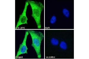 ABIN1590087 Immunofluorescence analysis of paraformaldehyde fixed HeLa cells, permeabilized with 0. (ATF6 Antikörper  (AA 437-449))