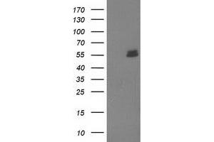 Image no. 1 for anti-U-Box Domain Containing 5 (UBOX5) (AA 1-130), (AA 419-487) antibody (ABIN1490571) (UBOX5 Antikörper  (AA 1-130, AA 419-487))