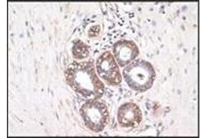 Immunohistochemistry (IHC) image for anti-S-100 (C-Term) antibody (ABIN870449) (S-100 Antikörper  (C-Term))