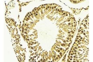 ABIN6269047 at 1/100 staining Mouse testis tissue by IHC-P. (IKBKB Antikörper)
