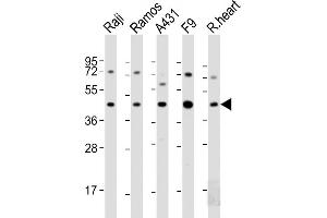 All lanes : Anti-MCL1 Antibody (BH3 Domain Specific) at 1:2000 dilution Lane 1: Raji whole cell lysate Lane 2: Ramos whole cell lysate Lane 3: A431 whole cell lysate Lane 4: F9 whole cell lysate Lane 5: A20 whole cell lysate Lysates/proteins at 20 μg per lane. (MCL-1 Antikörper  (AA 191-226))