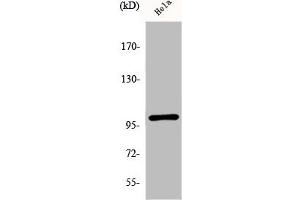 Western Blotting (WB) image for anti-Nuclear Factor of kappa Light Polypeptide Gene Enhancer in B-Cells 1 (NFKB1) (pSer893) antibody (ABIN7182113)