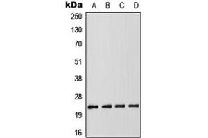 Western blot analysis of RAIDD expression in MCF7 (A), K562 (B), SP2/0 (C), PC12 (D) whole cell lysates. (CRADD Antikörper  (Center))