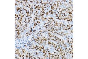 Immunohistochemistry of paraffin-embedded rat ovary using P2RY14 Rabbit pAb (ABIN6131673, ABIN6145126, ABIN6145127 and ABIN6224204) at dilution of 1:200 (40x lens). (P2RY14 Antikörper  (AA 209-338))