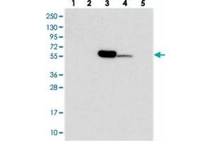 Western blot analysis of Lane 1: RT-4, Lane 2: U-251 MG, Lane 3: Human Plasma, Lane 4: Liver, Lane 5: Tonsil with C11orf80 polyclonal antibody  at 1:250-1:500 dilution. (C11ORF80 Antikörper)