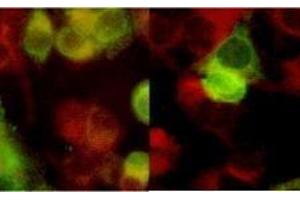 Immunofluorescence (IF) image for anti-Herpes Simplex Virus, Glycoprotein B (HSV gB) antibody (ABIN265573)