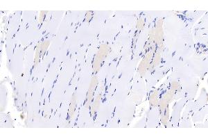 Immunohistochemistry (IHC) image for anti-Myosin Heavy Chain 7, Cardiac Muscle, beta (MYH7) (AA 1777-1935) antibody (ABIN7428827)
