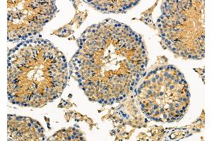 ABIN6259457 and ABIN6275785 at 1/100 staining Mouse testis tissue by IHC-P. (Phospholipase C beta 2 Antikörper  (Internal Region))