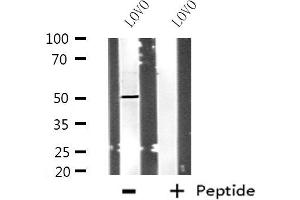 Western blot analysis of extracts from LOVO cells using POLD3 antibody. (POLD3 Antikörper  (C-Term))