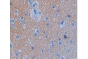 IHC-P analysis of Human Tissue, with DAB staining. (GLDC Antikörper  (AA 627-833))