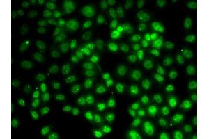 Immunofluorescence analysis of HeLa cells using PRMT2 antibody (ABIN5973447). (PRMT2 Antikörper)