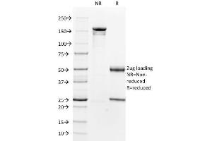 SDS-PAGE Analysis Purified Beta-2-Microglobulin Mouse Monoclonal Antibody (B2M/961). (beta-2 Microglobulin Antikörper)
