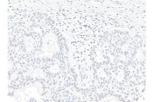 Immunohistochemistry (IHC) image for anti-Zinc Finger CCCH-Type Containing 4 (ZC3H4) (AA 1050-1100) antibody (ABIN7795759)
