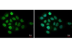ICC/IF Image MTA1 antibody [C1C3] detects MTA1 protein at nucleus by immunofluorescent analysis.