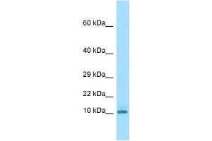 WB Suggested Anti-Krtap3-3 Antibody Titration: 1. (KRTAP3-3 Antikörper  (N-Term))