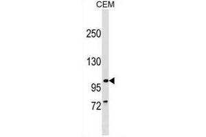 PTHB1 Antibody (C-term) (ABIN1537602 and ABIN2849688) western blot analysis in CEM cell line lysates (35 μg/lane). (BBS9 Antikörper  (C-Term))