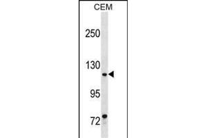 MKL1 Antibody (Center) (ABIN1538460 and ABIN2850260) western blot analysis in CEM cell line lysates (35 μg/lane).