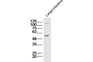 Lane 1: Mouse intestine lysates probed with ZnT-1 Polyclonal Antibody, Unconjugated  at 1:300 overnight at 4˚C. (SLC30A1 Antikörper  (AA 131-330))