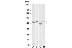 Western blot testing of mouse brain (lane A), rat brain (lane B), mouse thymus (lane C) and rat thymus (lane D) lysates with MEIS2 antibody at 0. (MEIS2 Antikörper)