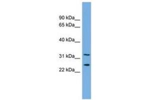 Image no. 1 for anti-Zinc Finger Protein 265 (Zranb2) (AA 143-192) antibody (ABIN6744705) (ZNF265 Antikörper  (AA 143-192))