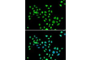 Immunofluorescence analysis of U20S cell using H2AFY antibody. (H2AFY Antikörper)
