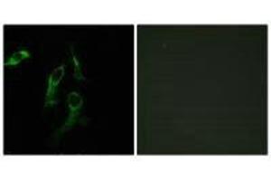 Immunofluorescence analysis of HepG2 ells, using HARS antibody. (HARS1/Jo-1 Antikörper  (C-Term))