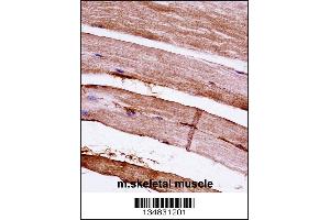 Mouse Mapkapk3 Antibody immunohistochemistry analysis in formalin fixed and paraffin embedded mouse skeletal muscle followed by peroxidase conjugation of the secondary antibody and DAB staining. (MAPKAP Kinase 3 Antikörper  (N-Term))