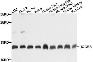 Western blot analysis of extracts of various cell lines, using UQCRB antibody (ABIN4905562) at 1:1000 dilution. (UQCRB Antikörper)