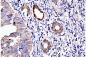 IHC analysis of HMGCS1 using anti-HMGCS1 antibody (ABIN7600928).
