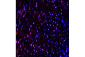 Immunofluorescence of paraffin embedded mouse heart using NSD3 (ABIN7076233) at dilution of 1:650 (400x lens) (WHSC1L1 Antikörper)