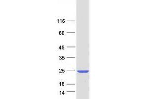 Western Blotting (WB) image for Centromere Protein M (CENPM) (Transcript Variant 1) protein (Myc-DYKDDDDK Tag) (ABIN2713909)