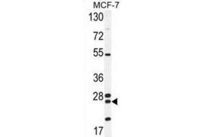 Western Blotting (WB) image for anti-Nudix Hydrolase 8 (NUDT8) antibody (ABIN2995714) (NUDT8 Antikörper)