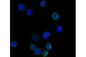 IF analysis of Il2ra using anti-Il2ra antibody (ABIN7600684). (CD25 Antikörper  (AA 22-268))