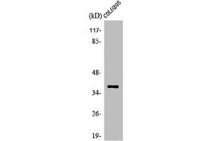 Western Blot analysis of Jurkat cells using Olfactory receptor 5K1 Polyclonal Antibody (OR5K1 Antikörper  (Internal Region))