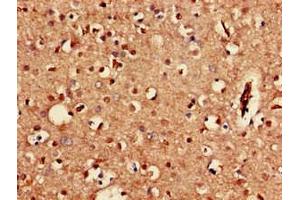 Immunohistochemistry of paraffin-embedded human brain tissue using ABIN7153285 at dilution of 1:100 (KCNJ3 Antikörper  (AA 350-487))