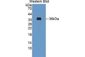Detection of Recombinant APBB3, Rat using Polyclonal Antibody to Amyloid Beta Precursor Protein Binding Protein B3 (APBB3)
