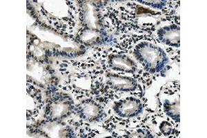 IHC analysis of LIN28A using anti-LIN28A antibody (ABIN7601176).