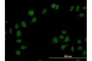 Image no. 3 for anti-Cullin-Associated and Neddylation-Dissociated 1 (CAND1) (AA 1-101) antibody (ABIN599270) (CAND1 Antikörper  (AA 1-101))