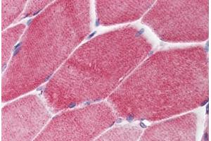 Human Skeletal Muscle (formalin-fixed, paraffin-embedded) stained with PAK2 antibody ABIN214460 at 2. (PAK2 Antikörper  (C-Term))
