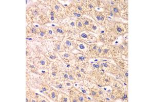 Immunohistochemistry of paraffin-embedded human liver injury using TXN2 antibody. (TXN2 Antikörper)