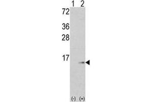 Western blot analysis of S100A6 antibody and 293 cell lysate (2 ug/lane) either nontransfected (Lane 1) or transiently transfected with the S100A6 gene (2).