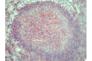 Immunohistochemistry (IHC) image for anti-MHC Class II HLA-DQ (HLA-DQ) antibody (Biotin) (ABIN452105) (HLA DQ Antikörper  (Biotin))