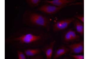 Immunofluorescent staining of methanol-fixed Hela cells using NFKB2 (phospho S870) polyclonal antibody  at 1:100-1:200 dilution.