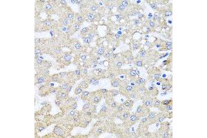 Immunohistochemistry of paraffin-embedded human liver injury using ARL6 antibody at dilution of 1:100 (x40 lens). (ARL6 Antikörper)