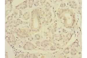 Immunohistochemistry of paraffin-embedded human salivary gland tissue using ABIN7151506 at dilution of 1:100 (SLC4A8 Antikörper  (AA 1-300))