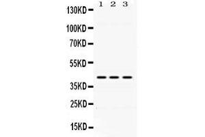 Western blot analysis of DHODH expression in rat liver extract ( Lane 1), mouse spleen extract ( Lane 2) and HEPG2 whole cell lysates ( Lane 3). (DHODH Antikörper  (N-Term))