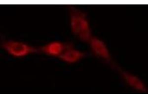 ABIN6274988 staining HepG2 cells by IF/ICC. (CEP170 Antikörper  (Internal Region))